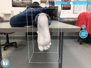 3D Imaging Custom Orthotics For Pain