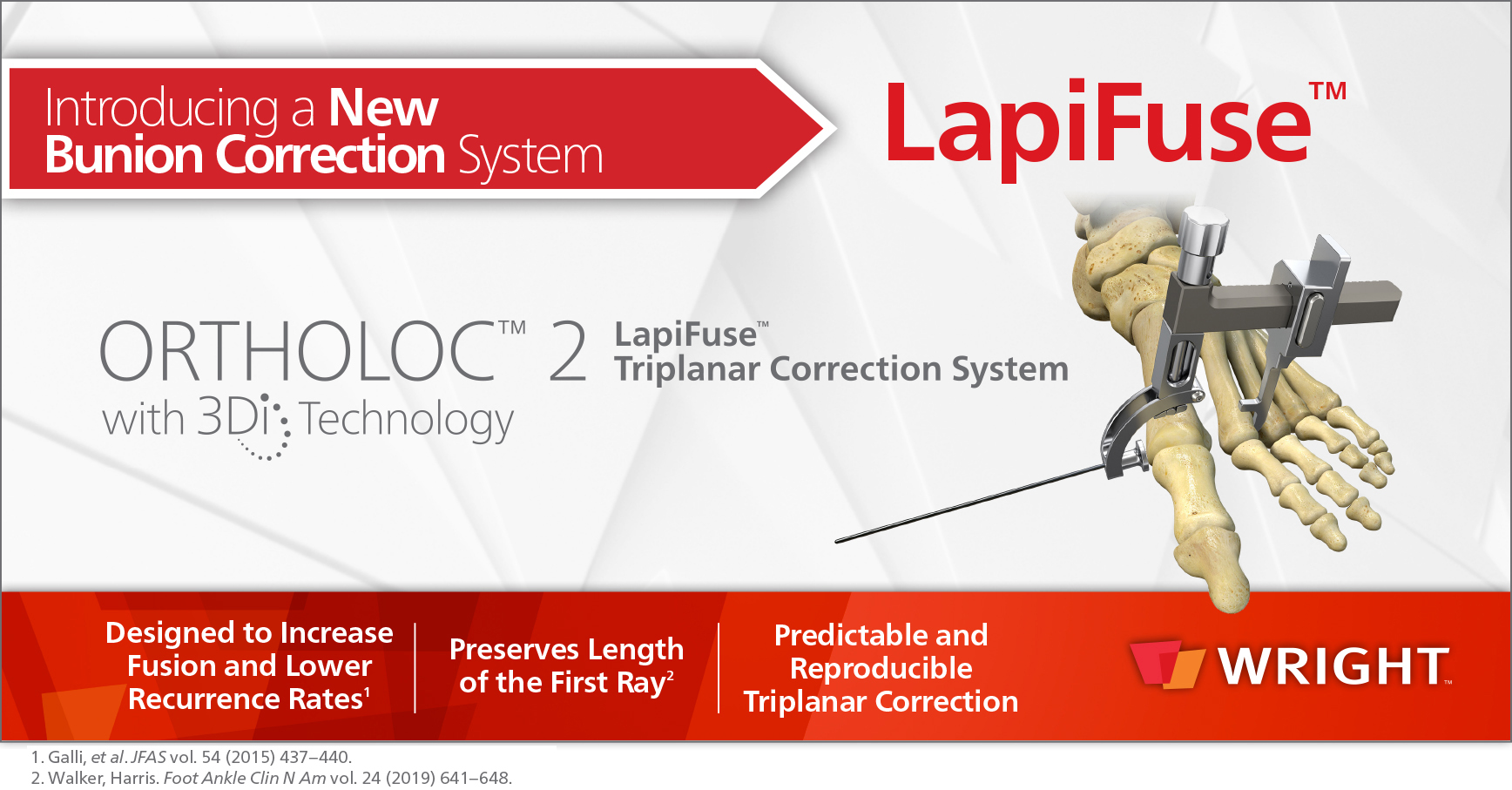 LapiFiuse bunionectomy allows predictable and reproducible correction in three dimensions while preserving the length of the great toe